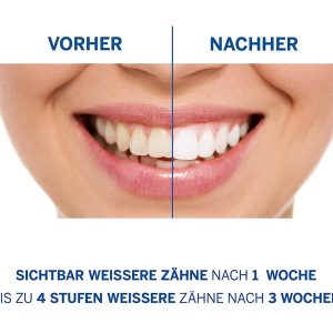 Kem Đánh Răng Perl Weiss Expert Weiss 50ml 5 Kem Đánh Răng Perl Weiss Expert Weiss 50ml